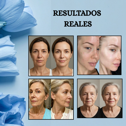El Secreto de la Piel de Porcelana- Tecnología Avanzada para Eliminar tus Arrugas desde el Primer Día.
